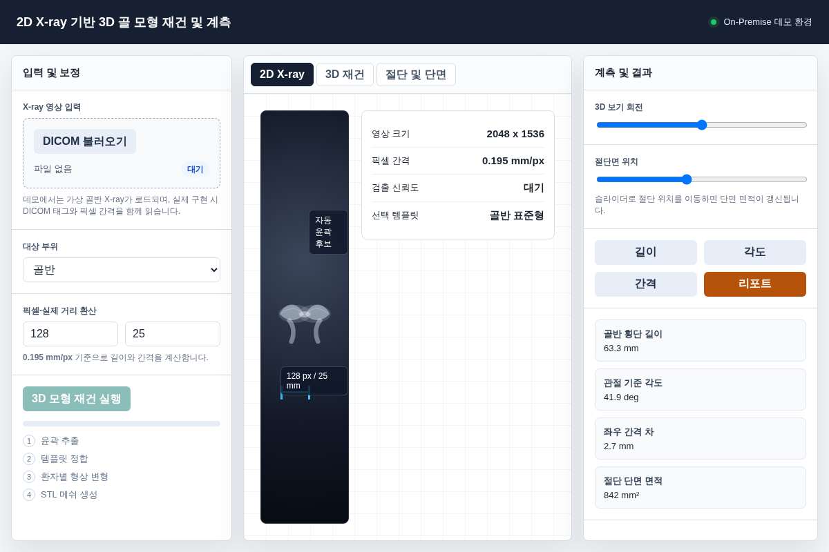 X-ray 3D 뼈 재건 데모